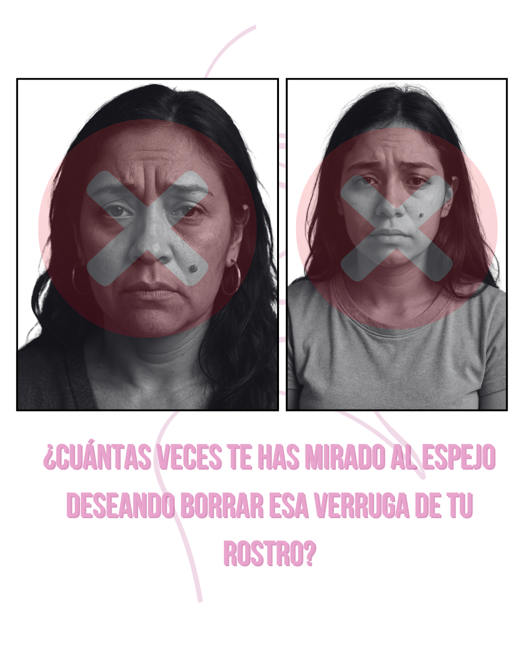 LUMINIIX - ADIÓS VERRUGAS