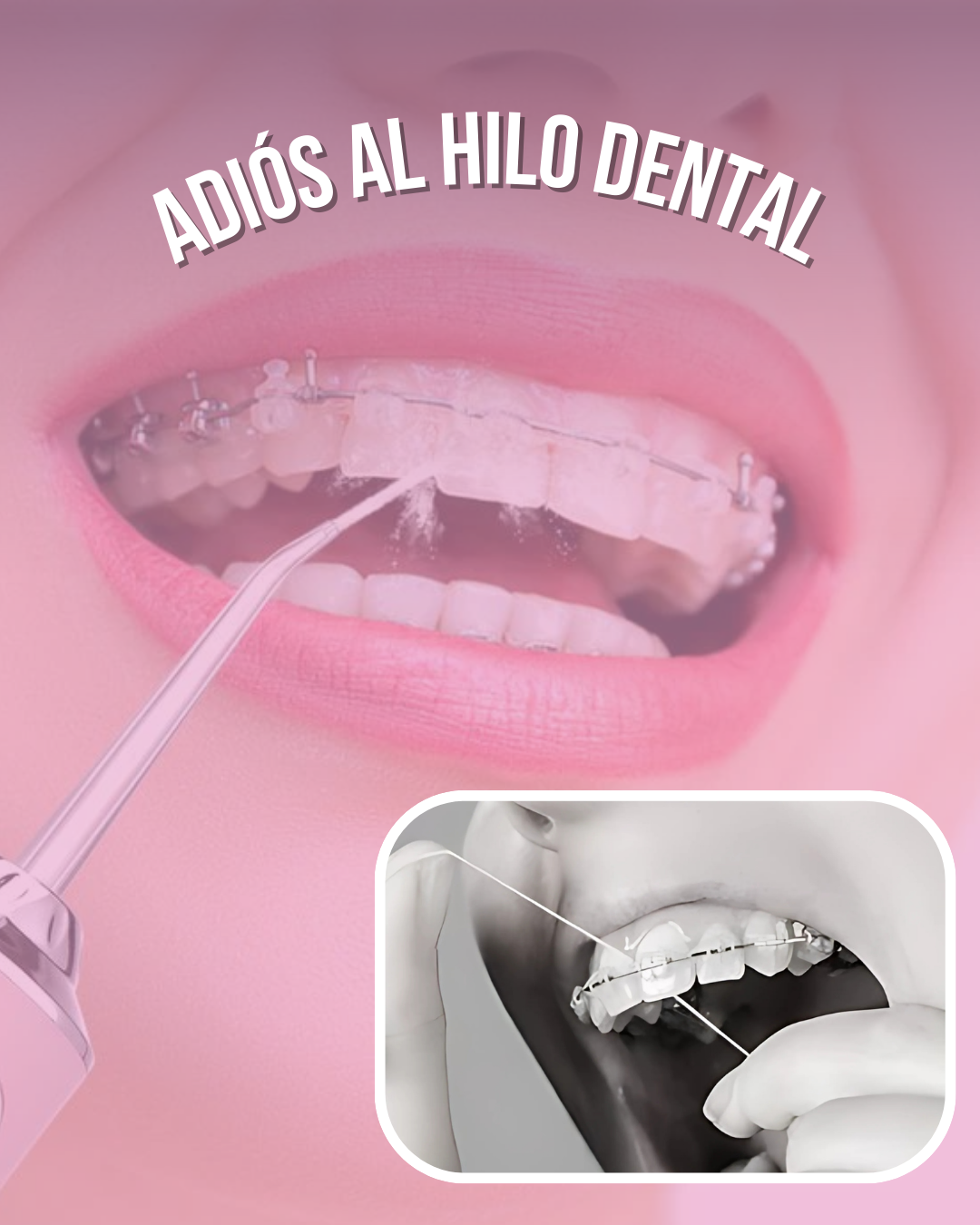 Irrigador Oral - Bella Boca ©