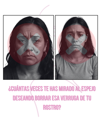LUMINIIX - ADIÓS VERRUGAS